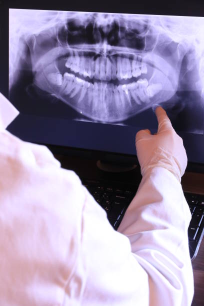 Best Same-Day Emergency Dental Services in Nipomo, CA